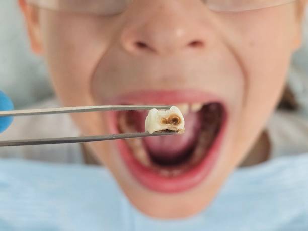 Best Cracked Tooth Emergency Dentist  in Larksville, PA